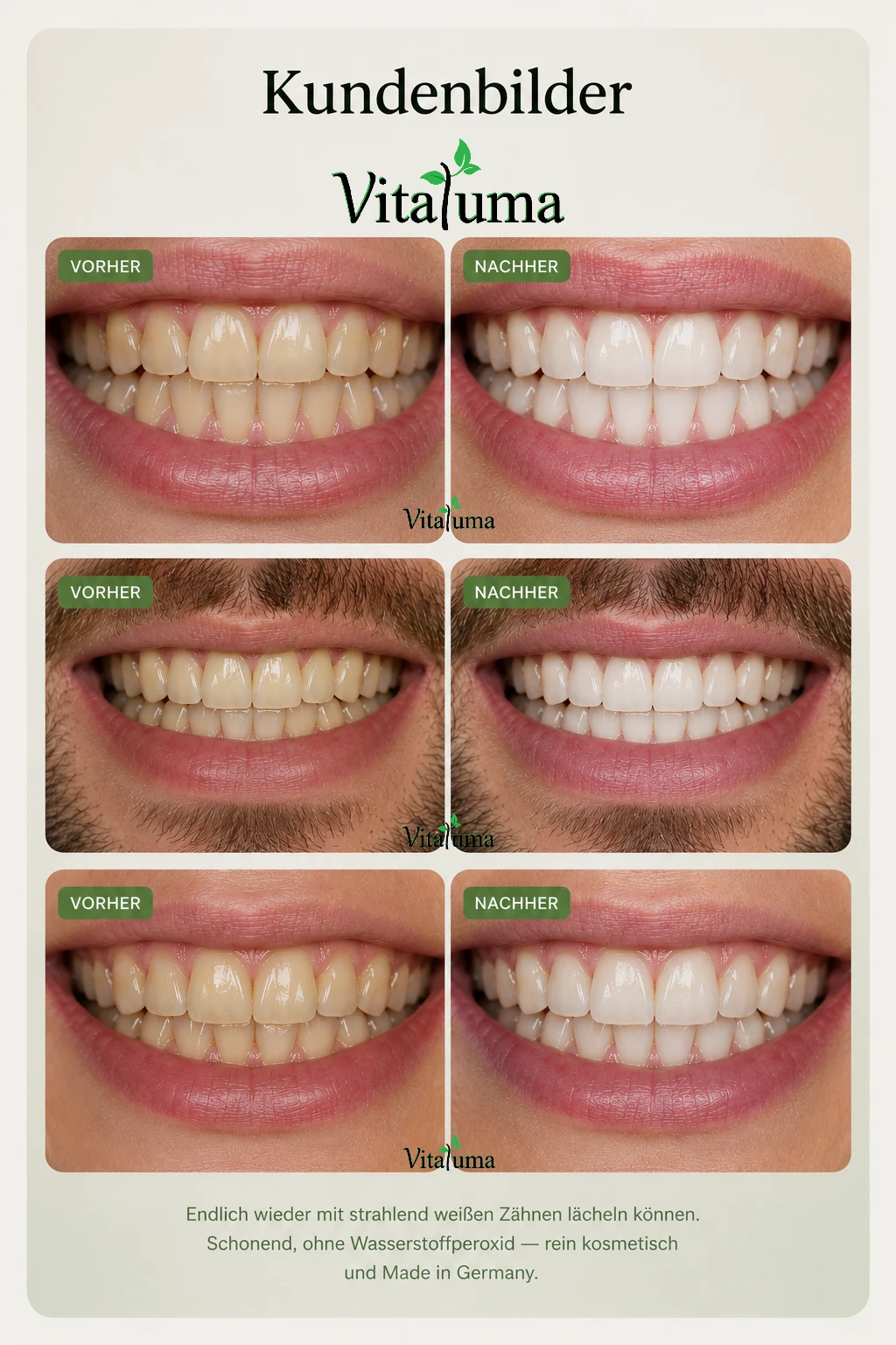 Zufriedener Vitaluma Kunde nach professionellem Zahnbleaching – sichtbar weißeres Lächeln